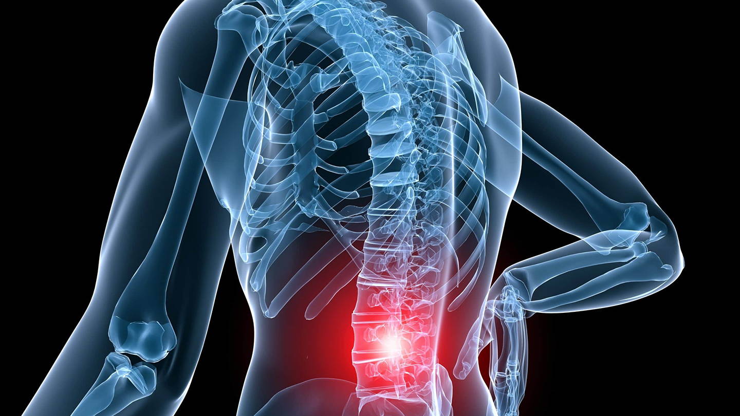 Back Pain – SATISFY